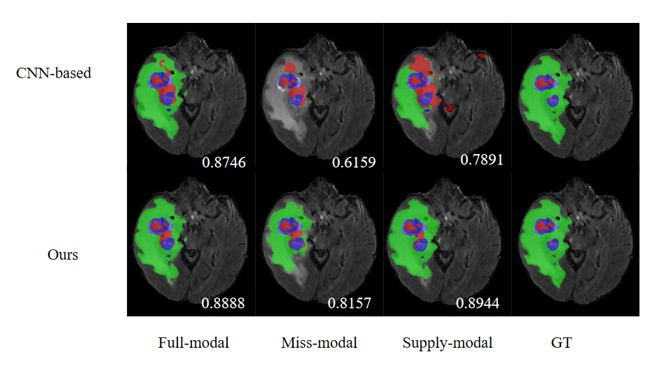 Diffusion-guided segmentation result